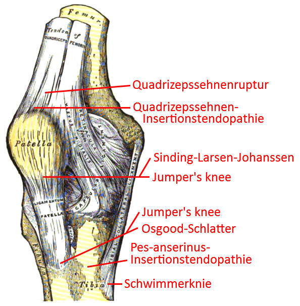 Pathologie